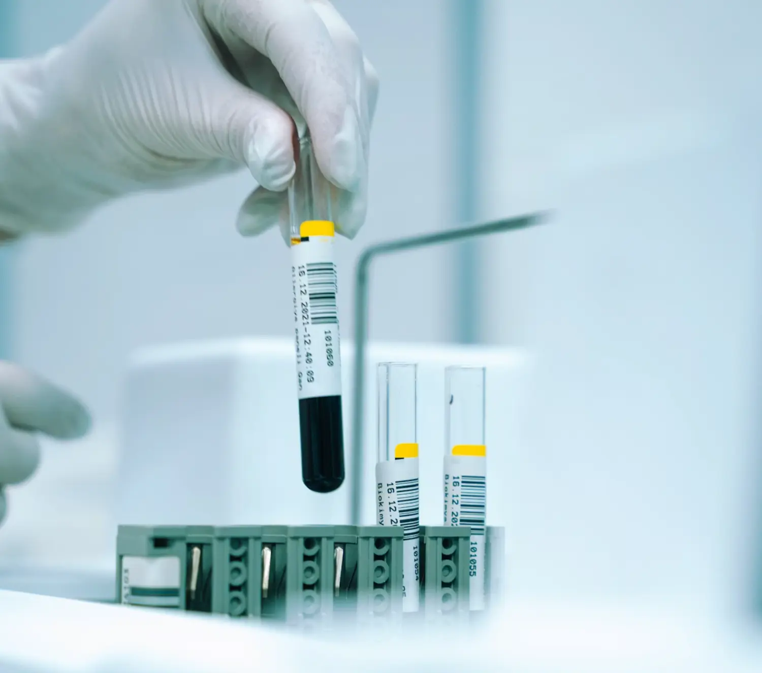 Provette del laboratorio analisi del centro medico